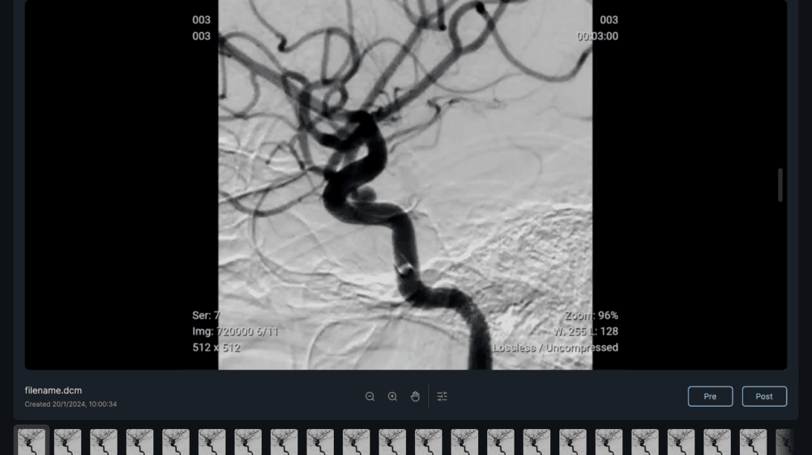 New Case - Select Image Aplikasi QAS AI